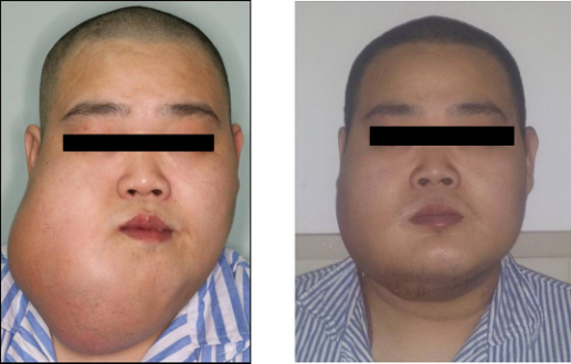 口腔颌面外科排名_口腔颌面外科(3)